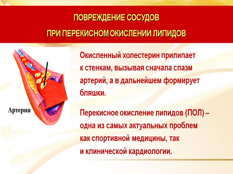 ПОВРЕЖДЕНИЕ СОСУДОВ  ПРИ ПЕРЕКИСНОМ ОКИСЛЕНИИ ЛИПИДОВ Перекисное окисление липидов (ПОЛ) –  одна